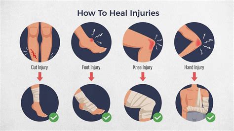 common sports injuries and their prevention tips onlymyhealth