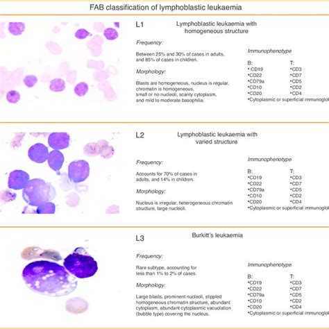 Acute Lymphoblastic Leukemia Detection And Classification Of Its Hot Sex Picture