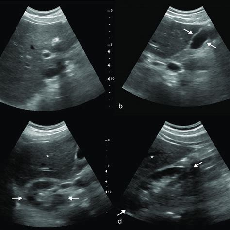 Overview Of The Ruq Telediagnostic Ultrasound System Imaging