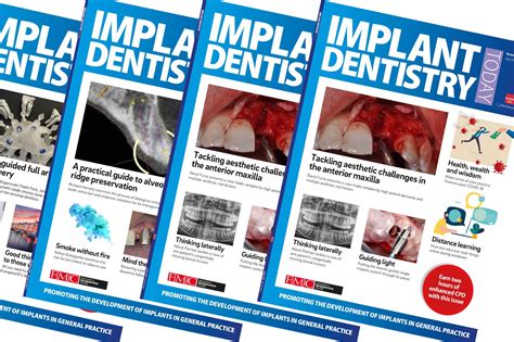 Implant Dentistry Today March Issue Now Ready To Read Dentistry Online