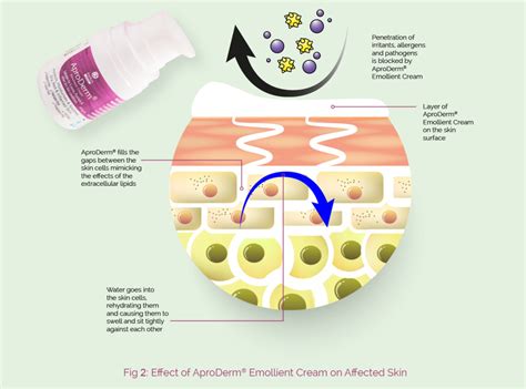 What Is Aproderm® Aproderm®