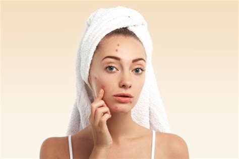 4 Kandungan Skincare yang Perlu Dicoba Acne Fighter, Apa Saja?