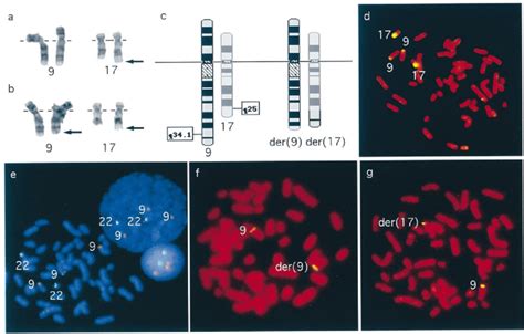 Cytogenetic And Molecular Cytogenetic Analysis Of The Proband And His