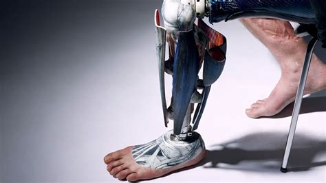 What Materials Are Most Commonly Used Now For Prosthetics
