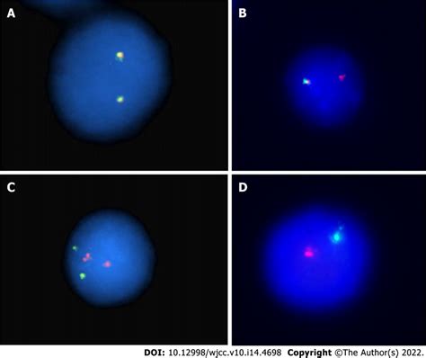 Interphase Fluorescence In Situ Hybridization Analysis A Interphase