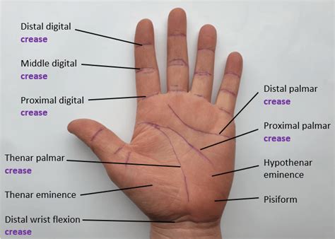 Landmarks Of The Palmar Hand Download Scientific Diagram