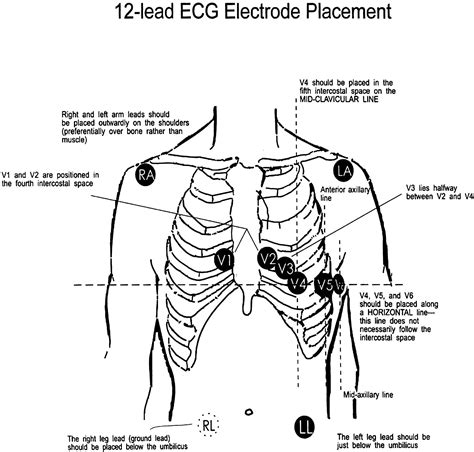 Download Figure Ekg Placement Nursing Information Medical Drawings
