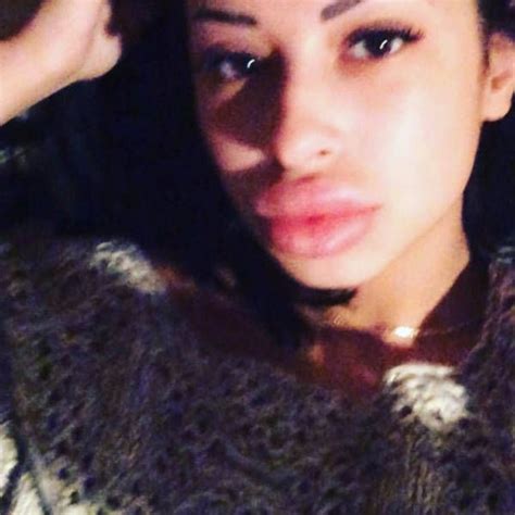 Anya Flaunts Her Massive Fake Lips Pics