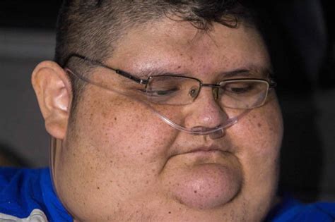 Worlds Fattest Man Juan Pedro Franco Needs Surgery To Lose 79 Stone