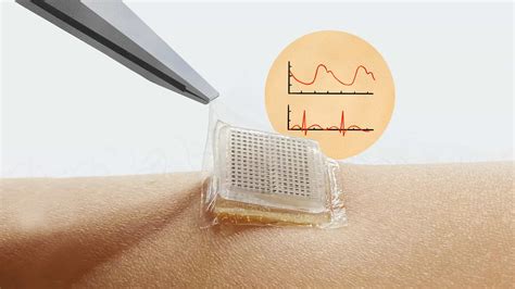 Wearable Ultrasound Patch Could Expand Access To Medical Imaging