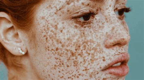 Why Do Freckles Come Out In The Sun — How To Be A Redhead Redhead Makeup