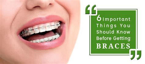 6 Important Things You Should Know Before Getting Braces Creative Dental Clinic
