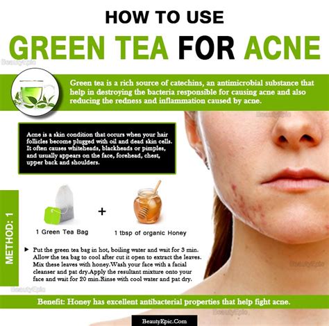 How To Use Green Tea For Acne