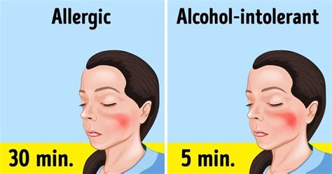 6 Signs Of Alcohol Intolerance You Might Be Unaware Of Healthw