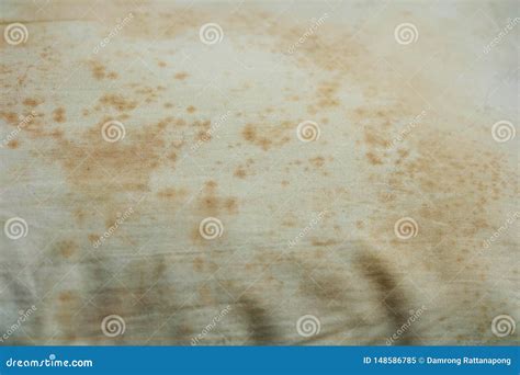 Close Up Stains On Dirty Pillow Are A Source Of Germs And Dust Mites