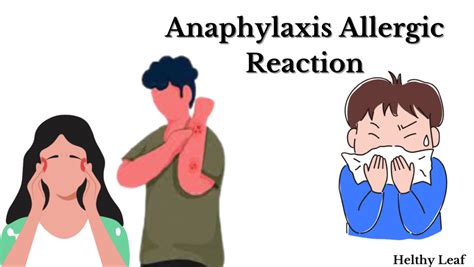 7 Effective Ways To Fight Anaphylaxis Allergic Reaction Helthy Leaf