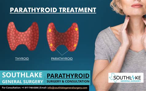 Parathyroid Treatment And Consultation Southlake General Surgery