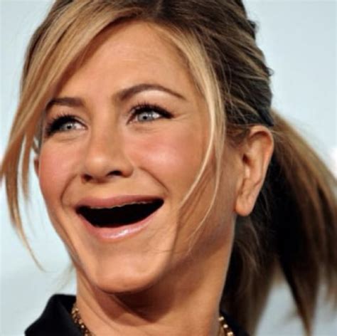 The Internet Is Full Of Pictures Of Celebrities Without Teeth For Some