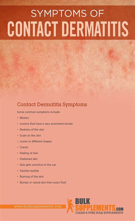 Contact Dermatitis Symptoms Causes And Treatment