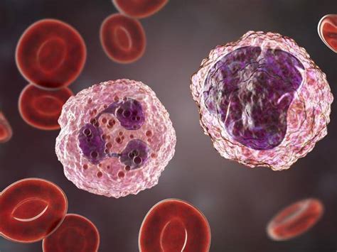White Blood Cells Identified To Exacerbate Damage In Ischemic Stroke