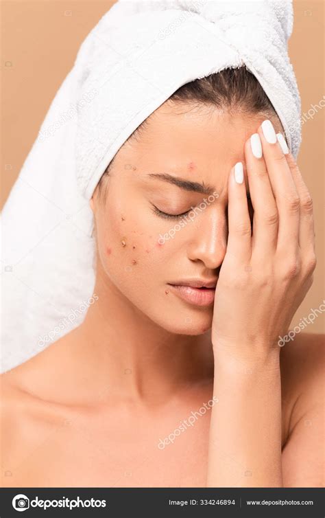 Frustrated Nude Girl Acne Covering Face Isolated Beige Stock Photo By