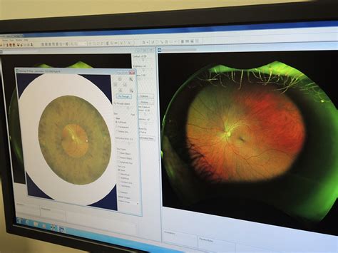 Optomap Retinal Imaging Comes To Montgomery Vision Care Montgomery