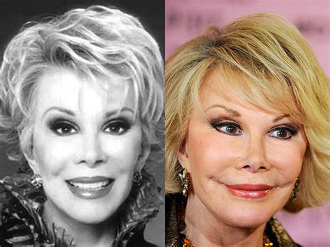 Joan Rivers Celebrity Plastic Surgery Disasters Cbs News