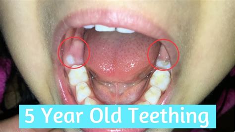 5 Years Old And Still Teething 😲😬 Vlog Youtube