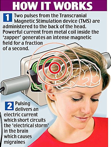 Button Pushing Device Helps Those Who Suffer Migraines Health
