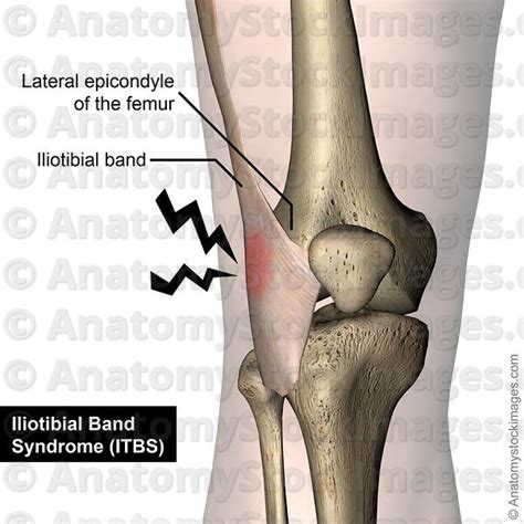 Anatomy Stock Images Knee Tractus Iliotibialis Iliotibial Band