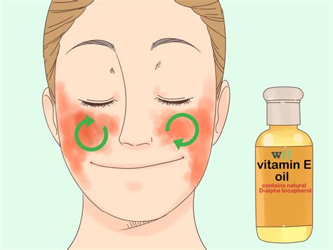 Treating eczema requires a little patience and a close watch. 3 Ways to Treat Face Eczema - wikiHow