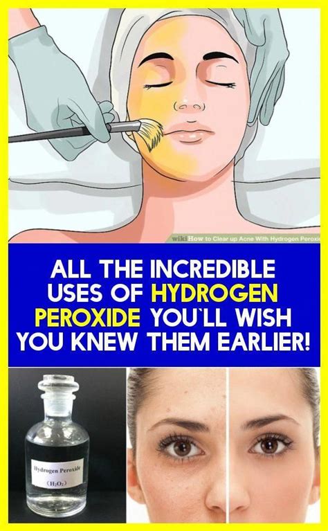 Causes include spicy foods, vitamin deficiencies, stress, autoimmune disorders, and hormone deficiencies. All The Incredible Uses Of Hydrogen Peroxide- You`ll Wish ...