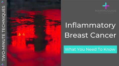 two minute techniques inflammatory breast cancer youtube