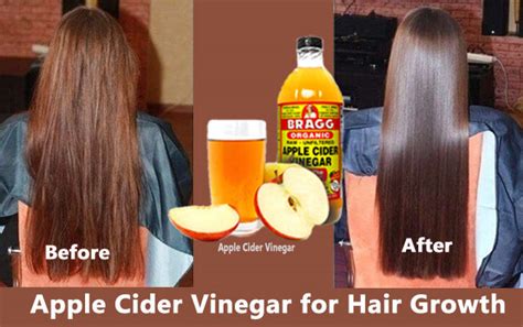 How To Use Apple Cider Vinegar For Hair Growth 5 Great Benefits