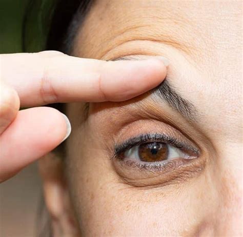 How To Get Rid Of Eye Bags An Experts Guide