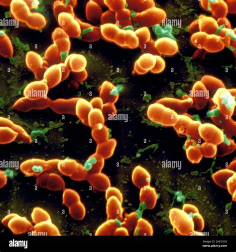 Streptococcus Pneumoniae Scanning Electron Micrograph Sem Of