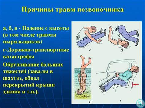 Компрессионный перелом позвоночника диета Компрессионный перелом поясничного отдела позвоночника - лечение Компрессионный перелом поясничного отдела позвоночника - лечение Компрессионный перелом позвоночника диета