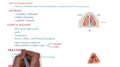 Septal Abscess Ent Lecture Youtube