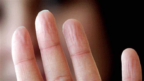 Especialistas desarrollan yemas de dedos con sensación similar a la