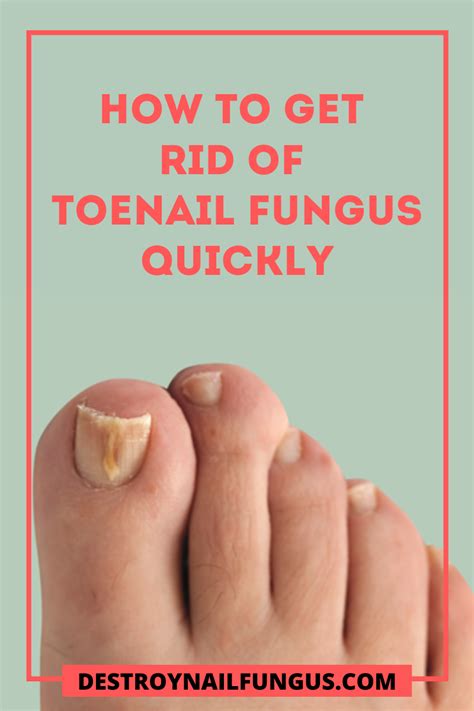 How To Get Rid Of Toenail Fungus Quickly What You Need To Know In