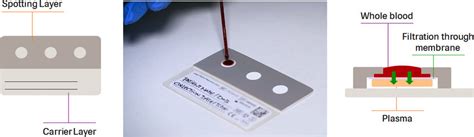 Cobas Plasma Separation Card Showing The Three Spots Left And How