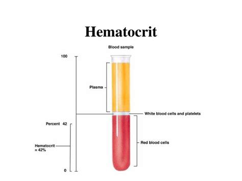 Hematocrit Pcv Or Hct As A Part Of Complete Blood Count Cbc Vip Lab