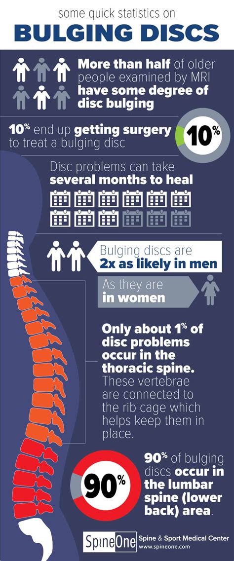Bulging Disc Infographic Statistics Patterns SpineOne