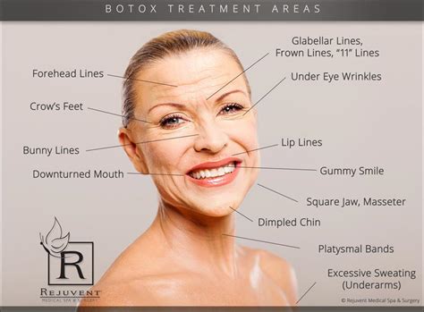 Botox Injections • Rejuvent Medical Spa And Surgery Scottsdale