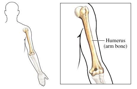 5) fraktur segmental, fraktur dimana tulang terpecah menjadi 6) fraktur depresi, fraktur yang terjadi pada sebagian atau beberapa bagian tulang. Pengertian Humerus (tulang lengan atas) dan fungsinya ...