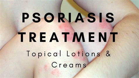 The Best Psoriasis Treatment Topical Lotion And Cream Reviews For
