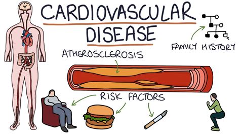 Understanding Cardiovascular Disease Visual Explanation For Students Youtube