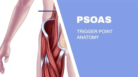 Psoas Trigger Points Youtube