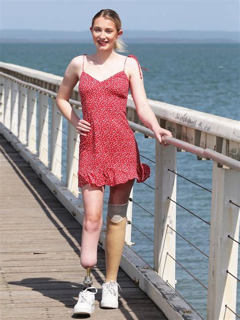 Tayla Egan Bionics Queensland Offers Hope To Young Amputee The