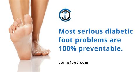 Diabetic Foot Care You Deserve In Kansas City Comprehensive Foot Centers